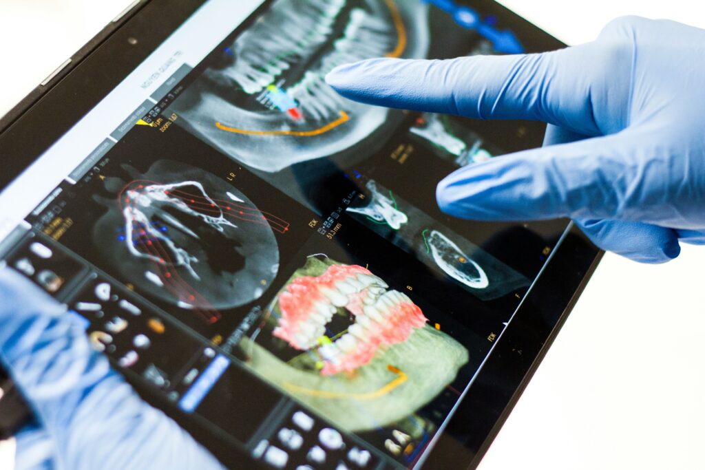 Advanced Training Techniques for Permanent Dental Staff
